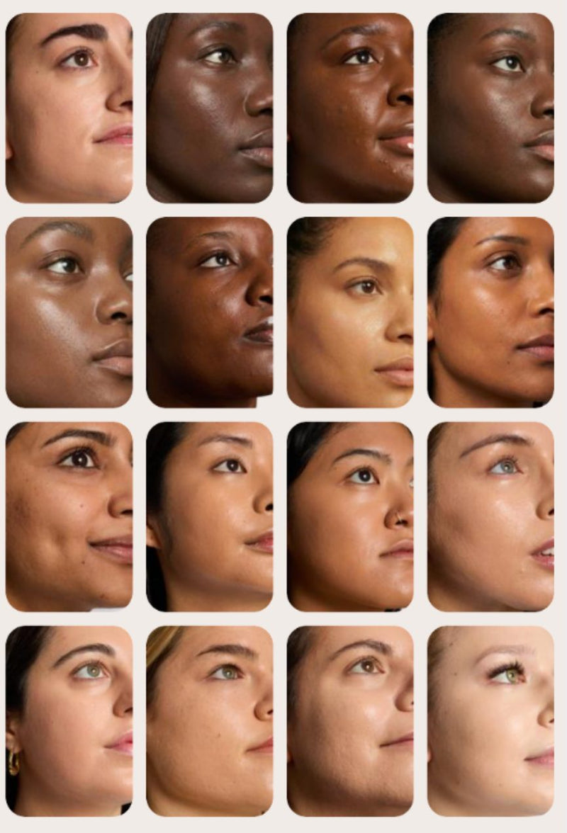 Skin Quiz