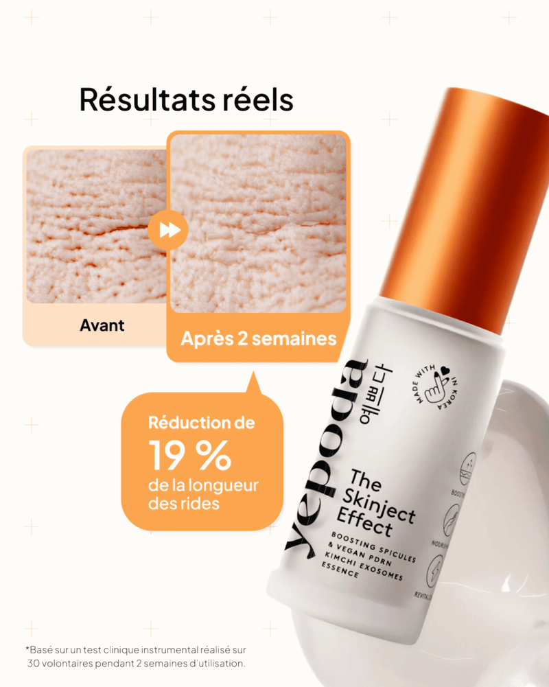 The Skinject Effect